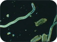 Adult female root-lesion nematode (150X) (Dr. John Potter, formerly Agriculture and Agri-Food Canada)