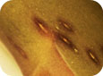 Purple Spot (Stemphylium) lesion close up
