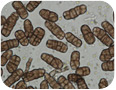 Stemphylium spores