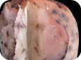 Pink rot symptoms after exposure to air