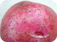 Lésions de gale argentée sur une variété de pomme de terre rouge