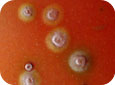 Lésions causées par la tache bactérienne sur une tomate