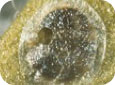 Codling moth egg parasitized by Trichogramma sp. wasp (note blackened appearance and emergence hole) (E. Beers, OPM Online, WSU) 