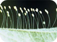 Lacewing eggs (D. Epstein, MSU)