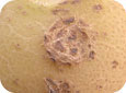 Superficial corky lesions (Russet scab)